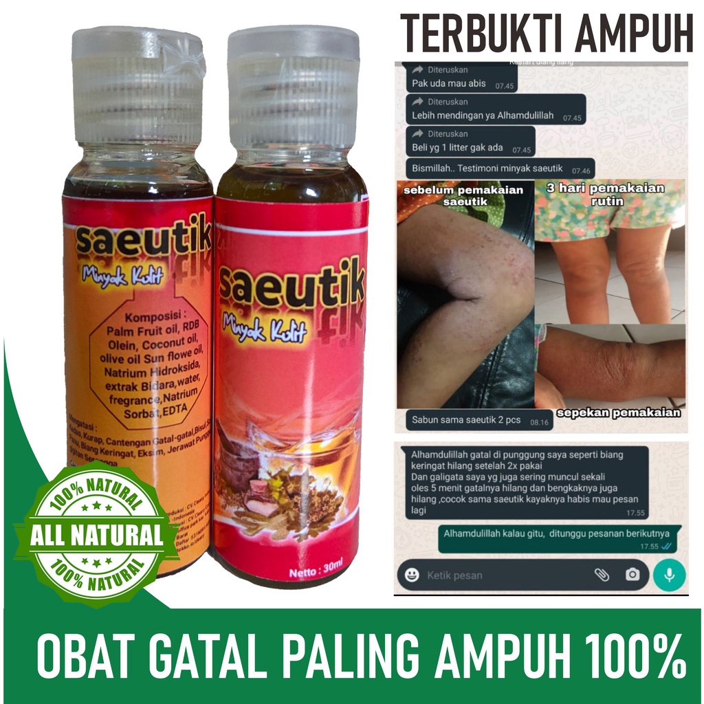 Salep minyak Obat Gatal Jamur Selangkangan Eksim Jerawat Panu Kurap Dijamin ampuh alami 100%