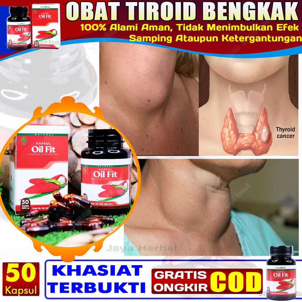 Obat Tiroid Bengkak Di Leher Sebelah Kanan Kiri Gondok Beracun Hipertiroid Gondongan Oil Fit Shopee Indonesia