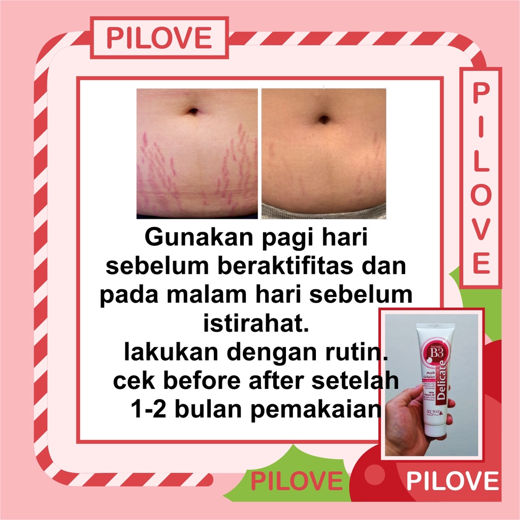 PILOVE - BISA COD Obat Salep Gel Lotion Cream Krim Penghilang Sterchmark / Strechmark Strech Mark Paling Ampuh Cream Penghilang Strecmark Sterch Mark Stretch Mark Cream Selulit Ibu Hamil dan Setelah Melahirkan Yang Paling Ampuh BPOM Permanen