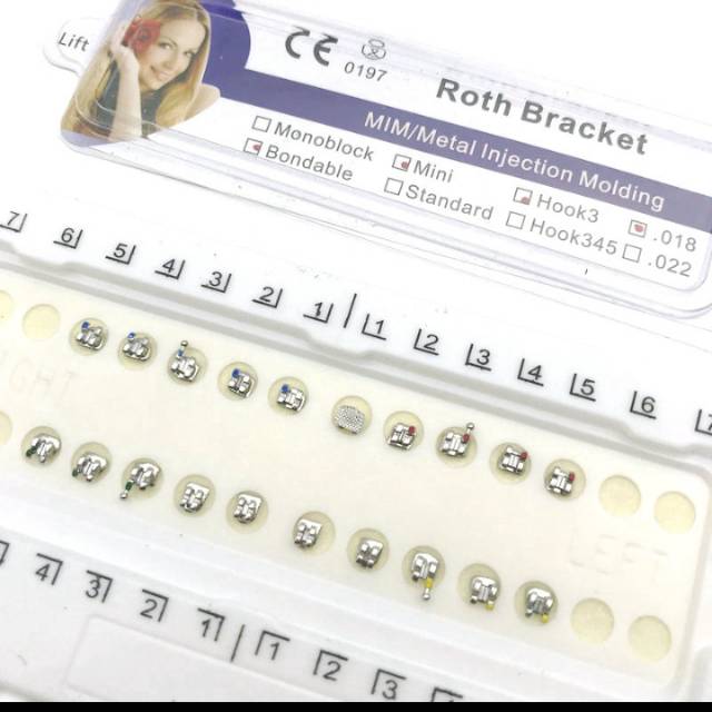 Bracket perawatan gigi. Bracket roth