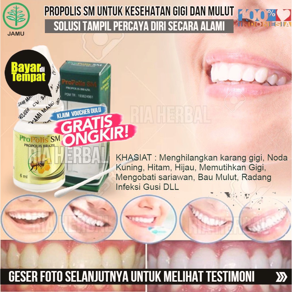 Obat Tetes Antibiotik Sakit Gigi Aman Bpom Anti Nyeri Gusi Terbagus Sariawan Abses Alami Propolis Shopee Indonesia