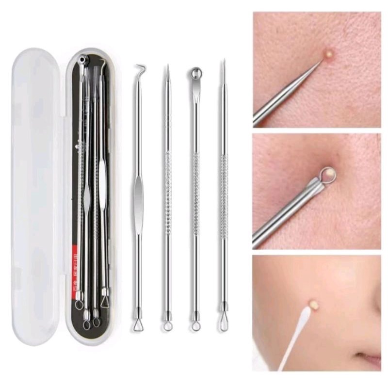 PINSET KOMEDO 4 IN 1 ALAT PENCET JERAWAT PEMBERSIH BLACKHEAD