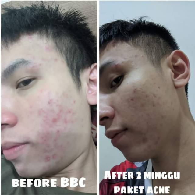 BBC skincare