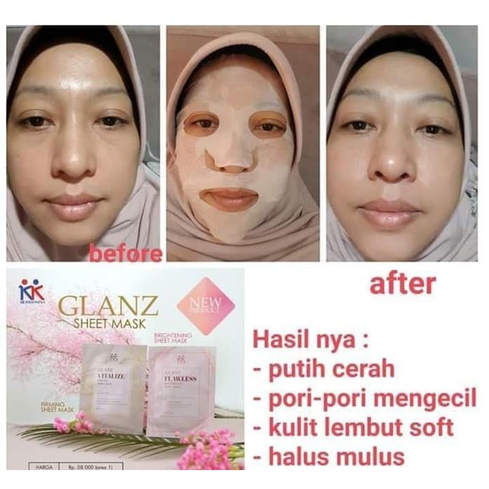 Beautyzen Mud Mask Masker Lumpur &amp; Glanz Sheet Mask Untuk Mencerahkan Mengencangkan KK Indonesia
