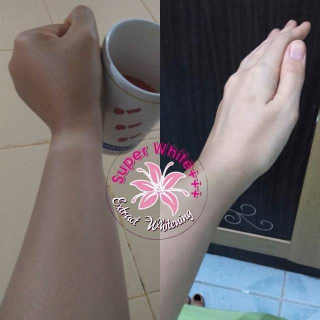 HB SUPERWHITE+++ / HB TANPA KELUPAS / PEMUTIH AMPUH 100%