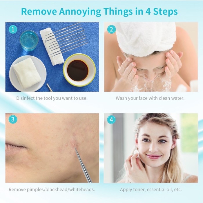 komedopinset- alat pencet komedo pinset pembersih blackhead penjepit komedo -pinset-komedo.