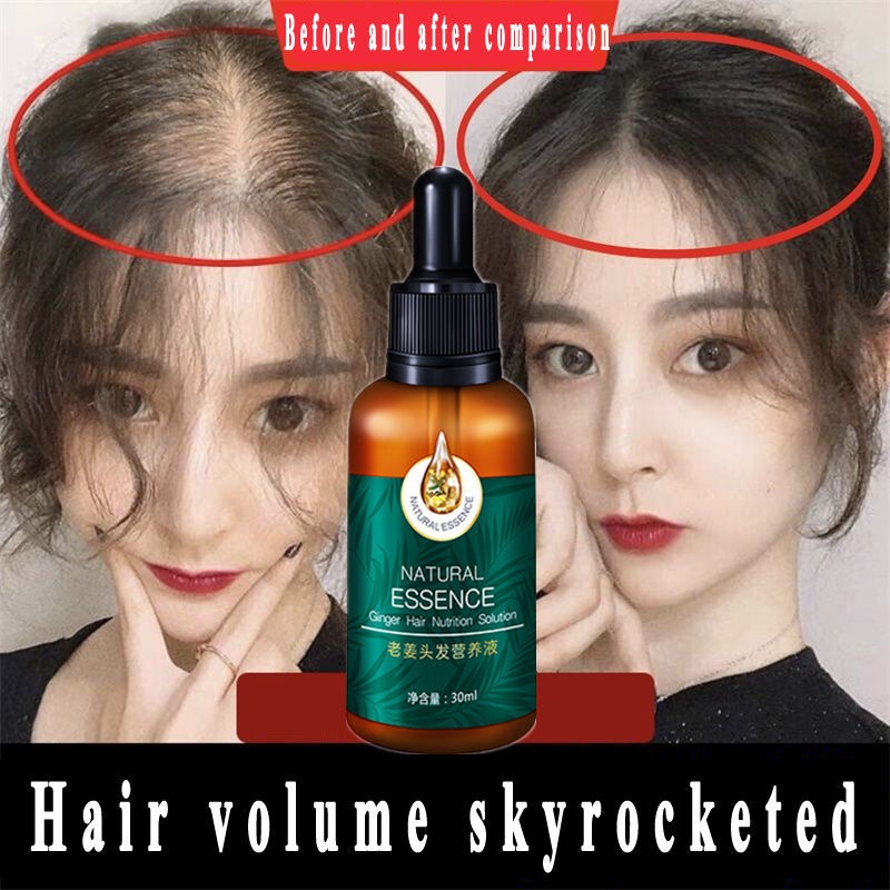 Minyak esensial perawatan rambut/ Anti-Hair Loss Serum/ Natural Essence Ginger Hair Tonic/ Toner Rambut Ekstrak Sari Jahe 30 ML