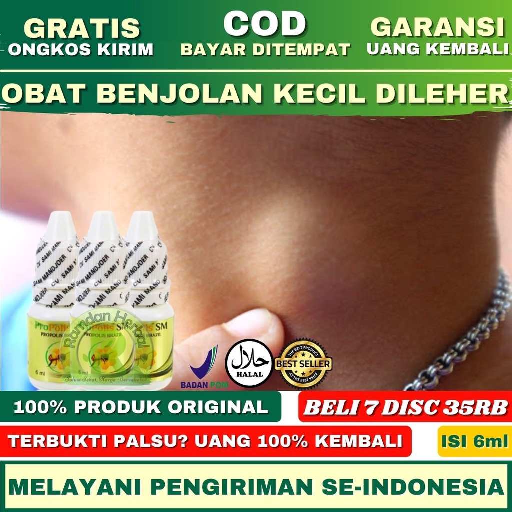 ✅ BPOM - Obat Benjolan Kecil Di Leher - Kelenjar Tiroid - Pembengkakan Tiroid - Gondok - Benjolan Le