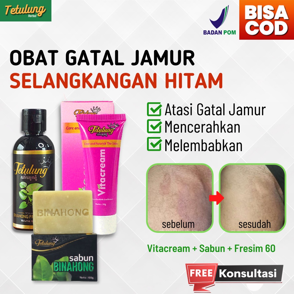 Jual Salep Gatal Selangkangan Eksim Dan Jamur Paling Ampuh Vitacream Sabun Binahong Fresim