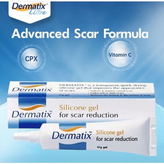 Dermatix Ultra Gel 15g Penghilang Bekas Luka Keloid Anti Scar Stretchmark 15 Gram Shopee Indonesia