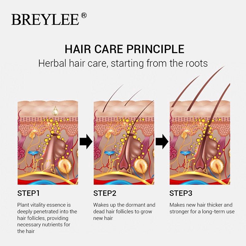 Breylee Minyak Esens Penumbuh Rambut Cepat 20mL HAIR GROWTH ESSENTIAL OIL Breylee Minyak Esens Penumbuh Rambut Cepat 20mL HAIR GROWTH ESSENTIAL OIL BE-04