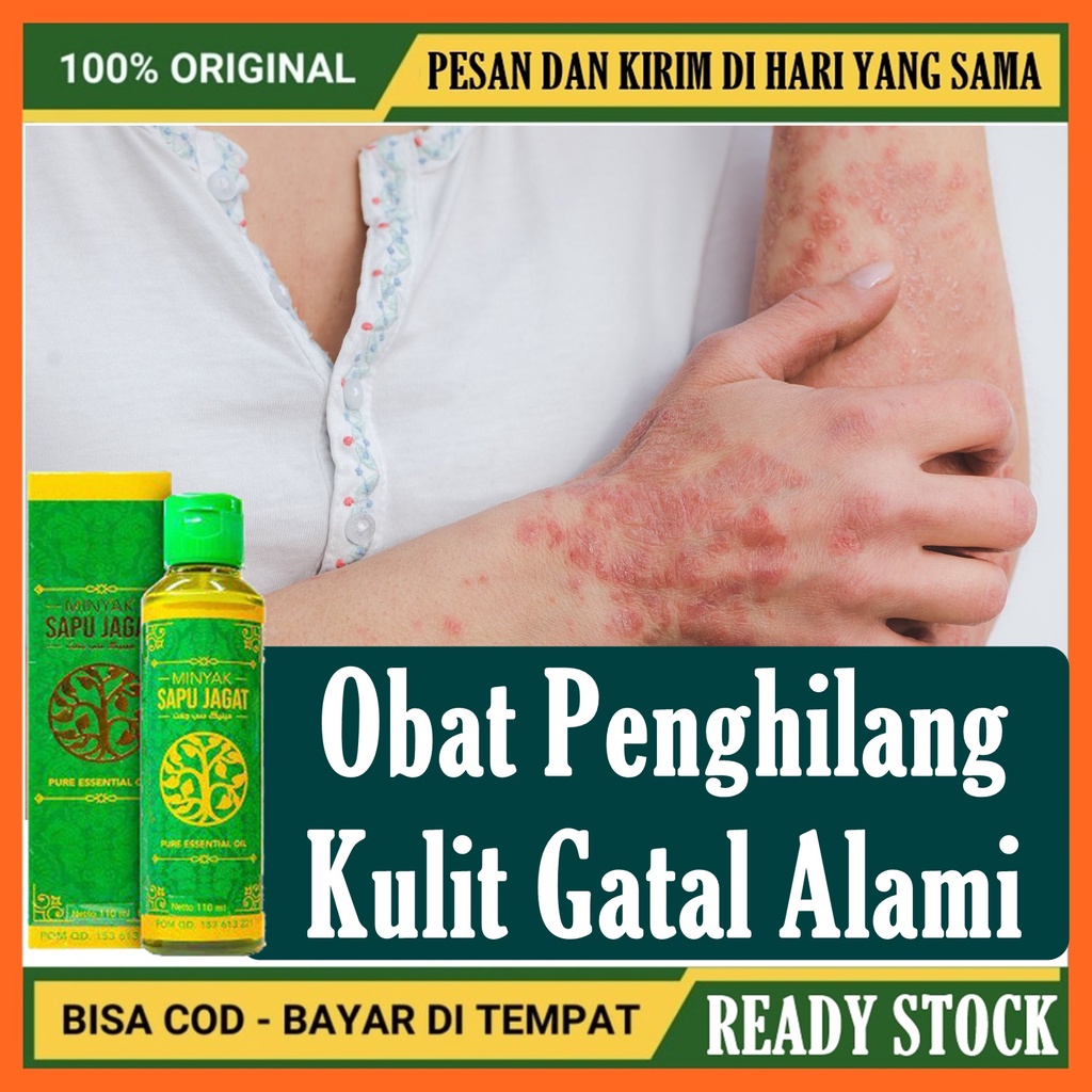 Minyak Oles Sapu Jagat Obat Kulit Gatal Herbal, Obat Kulit Gatal Alami - MINYAK SAPU JAGAT