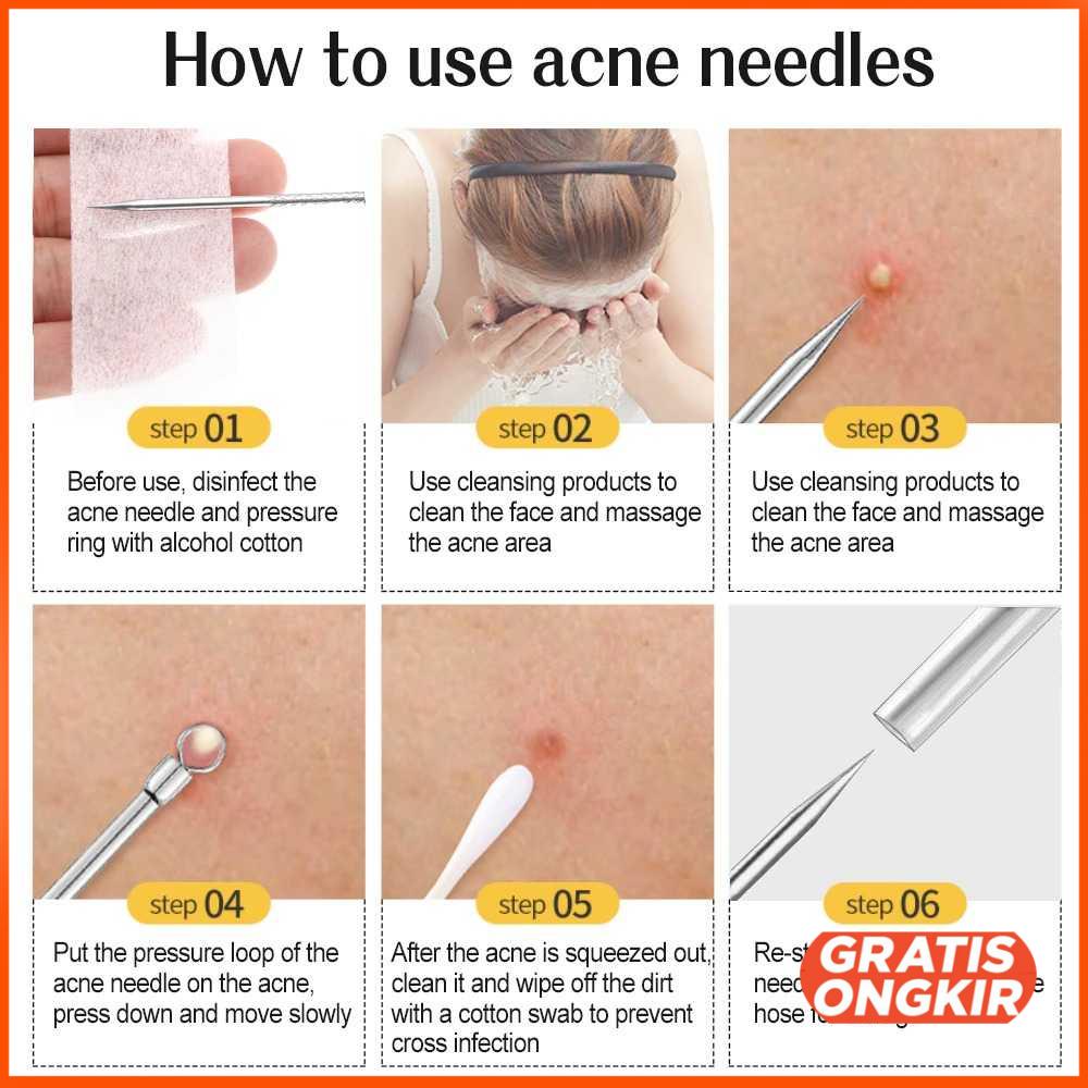 Alat Perlengkapan Komedo Jerawat Blackhead 7 PCS - PT8