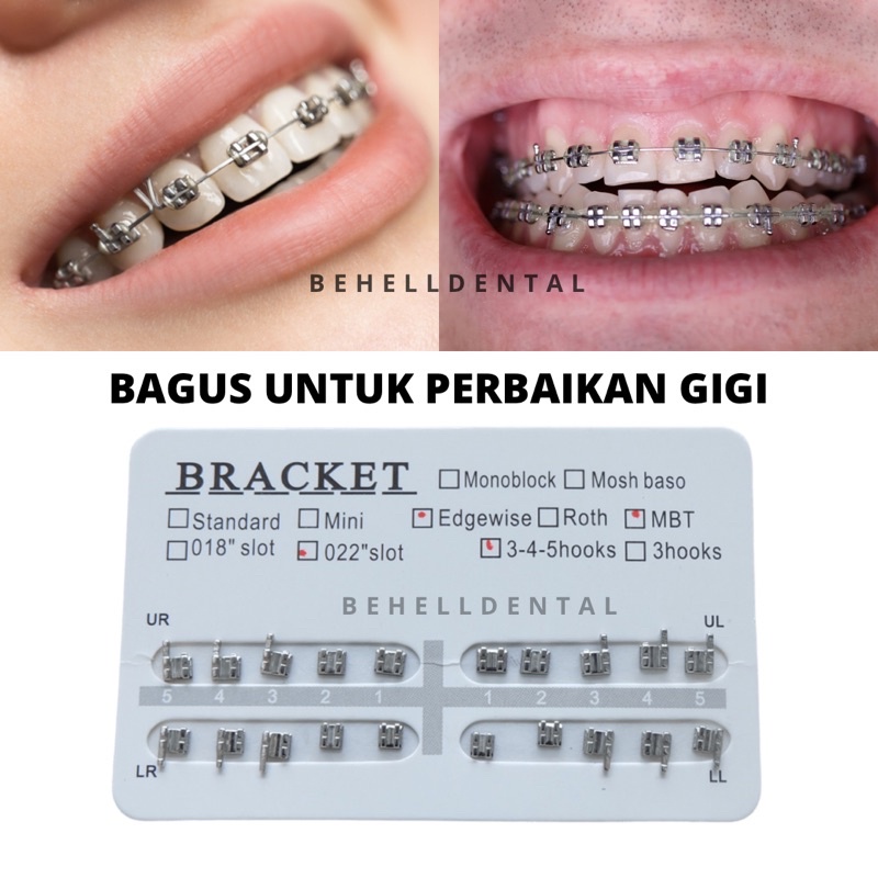 BRACKET BEHEL PERBAIKAN GIGI AMPLOP PUTIH HIGH QUALITY 345 HOOK EDGEWISE MBT //Kawat Gigi Dental Orthodontic Tanpa Kait Pinggir Tipe 3-4-5 Hook . 3 . No hook