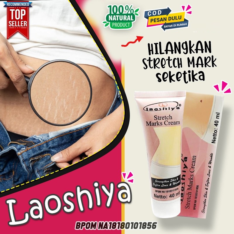 Laoshiya Obat Strechmark Paling Ampuh Laoshiya Cream Stretchmarks Cream Penghilang Strechmark Ampuh Permanen Bpom