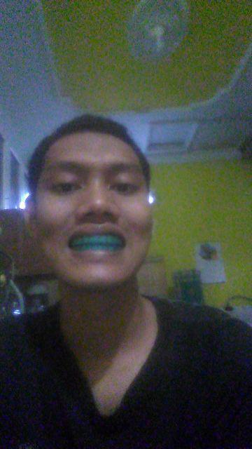 Perata Pelurus Merapikan Gigi Behel Karet Silikon Silicone Teeth Alignment Orthodontics Ortodontik