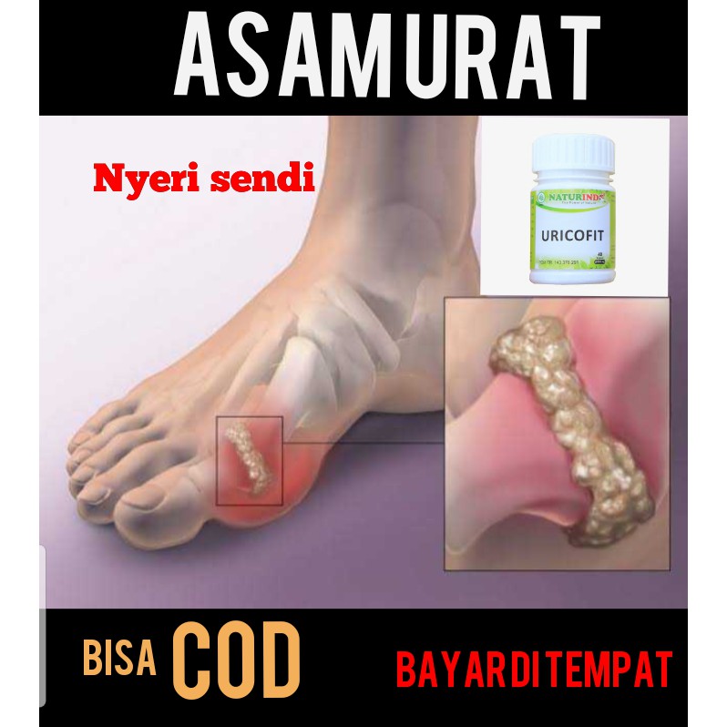 COD OBAT ASAM URAT HERBAL AMPUH ASAM URAT SENDI BENGKAK OBAT PENURUN ASAMURAT NATURINDO