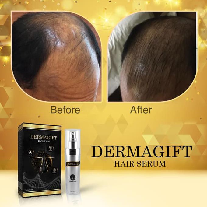 Perawatan Tubuh - Paket Dermagift - Gold