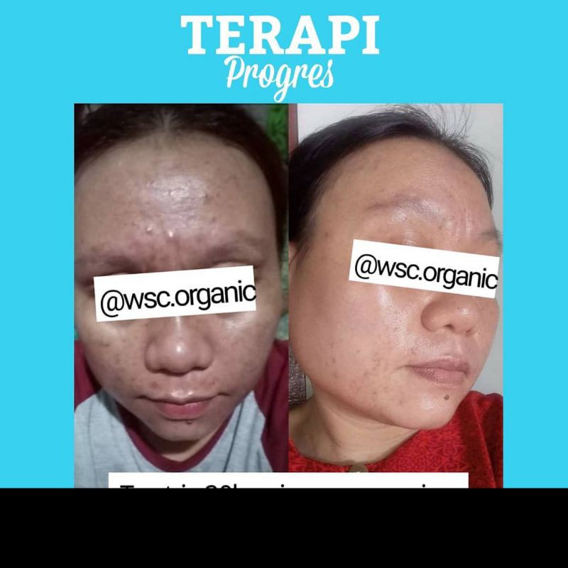 WSC Organic Mini pemutih wajah flek jerawat skincare glowing series viral