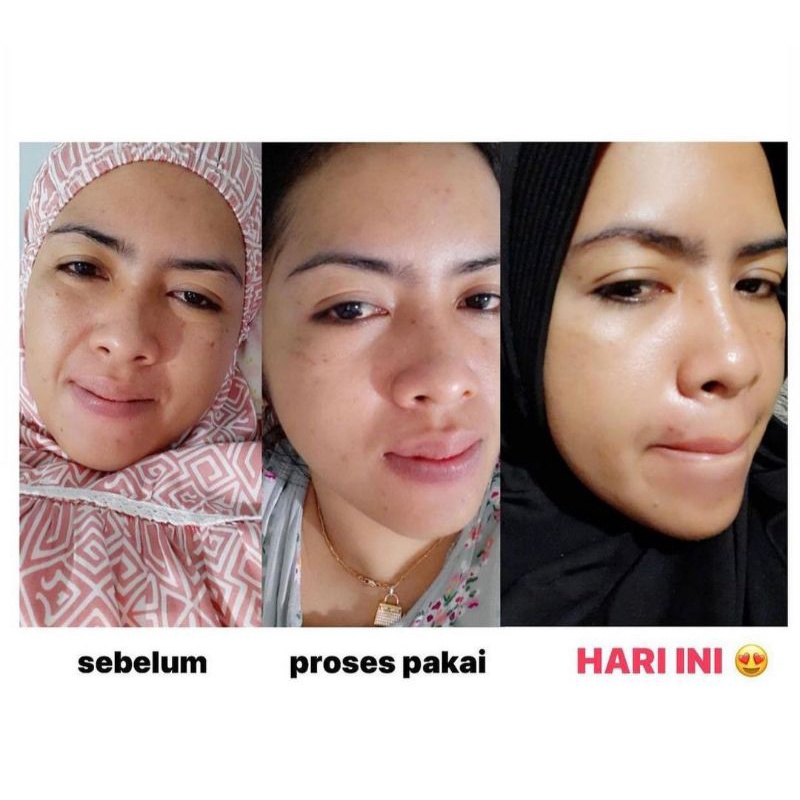 Daviena Skincare Paket Gold Series Davienaskincareofficial Davina Devina Lampung Surabaya Jakarta Pencerah Pemutih Flek Wajah Glowing Bpom Daviena Skincare-6