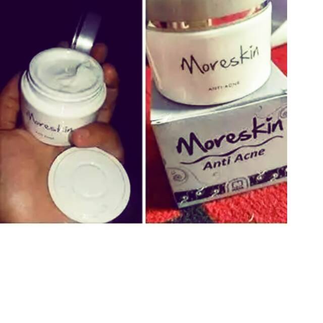 Moreskin anti acne