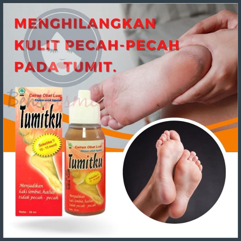 TUMITKU OBAT HERBAL MENGATASI KAKI PECAH PECAH