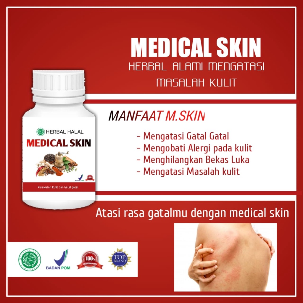 0BAT AMPUH PENGHILANG BEKAS LUKA AMPUH cepat permanen, obat luka bakar, obat penghilang keloid menon