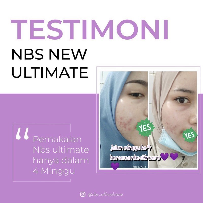 NBS EXTRA GLOW NEW PAKET NBS PEMUTIH WAJAH PENGHILANG FLEK JERAWAT KUSAM CREAM NBS ULTIMATE ORIGINAL BPOM-3