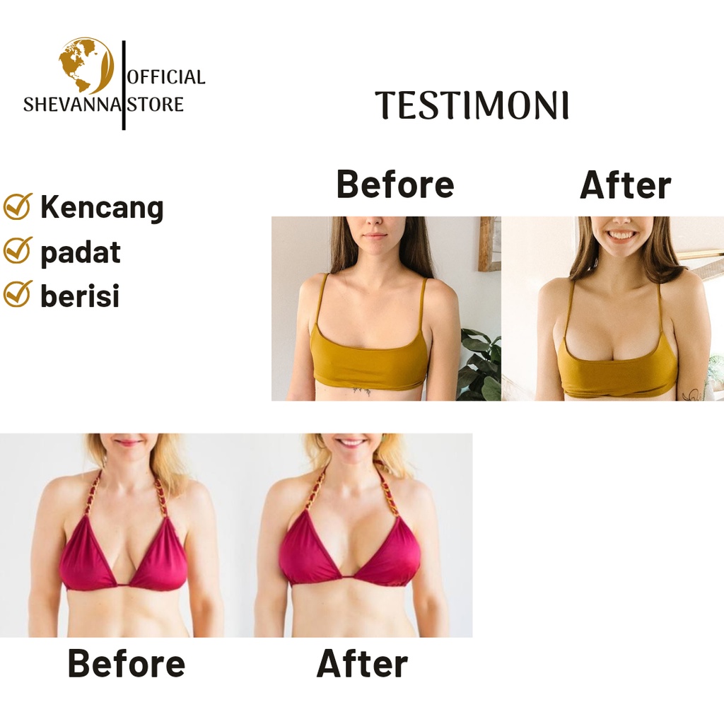 Pembesar Payudara dan Bokong Alami Cepat dan Ampuh Shevana Breast &amp; Bottom Serum 30ml