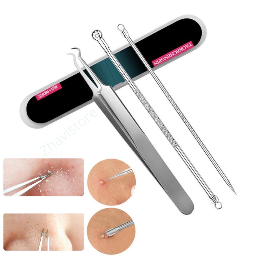 Pinset Komedo Pembersih Blackhead / Alat Pencet Komedo / Penjepit Komedo Acne Facial