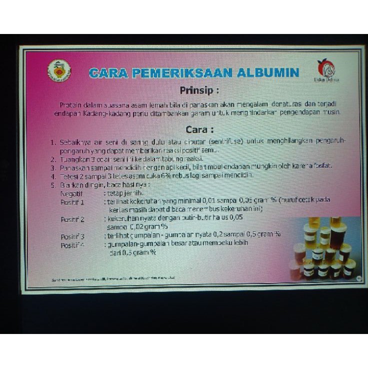 

POSTER CARA PEMERIKSAAN ALBUMIN (89)