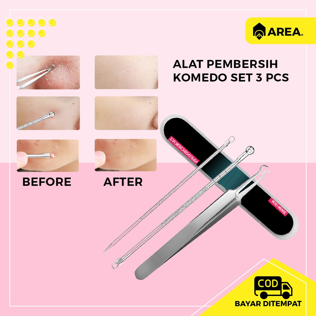 Alat Perlengkapan Komedo Jerawat Blackhead 3 PCS Putimi PT3