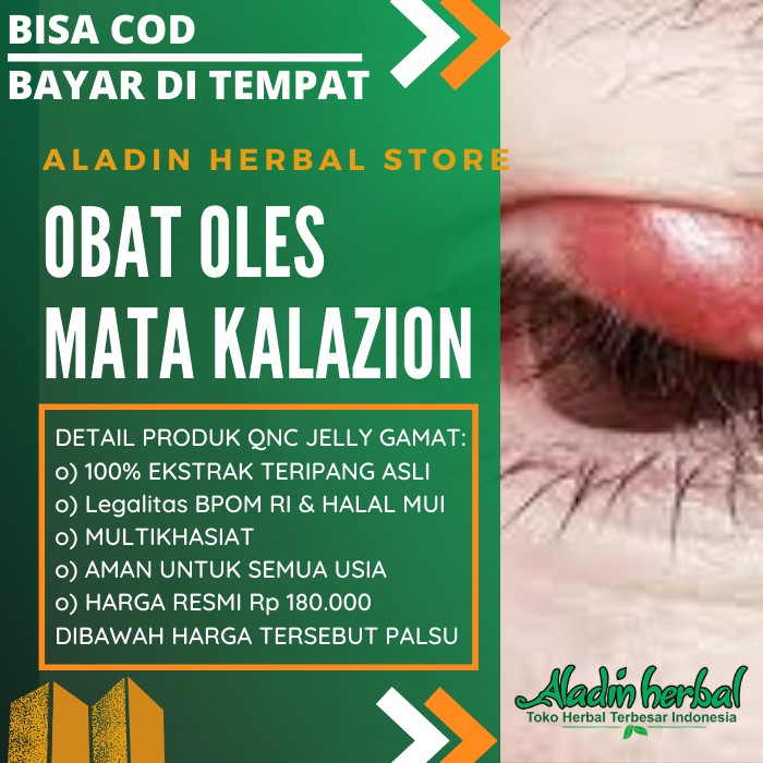 Cod Obat Kalazion Oles 100 Herbal Alami Benjolan Di Mata Bintitan Kanker Mata Gamat Shopee Indonesia