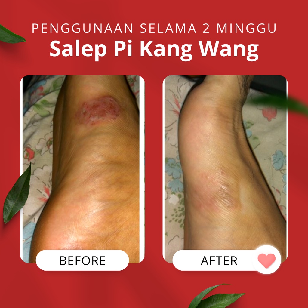 SALEP PI KANG WANG ORIGINAL 100% / SALEP PIKANGWANG ORIGINAL 100% ASLI / SALEP GATAL SELANGKANGAN