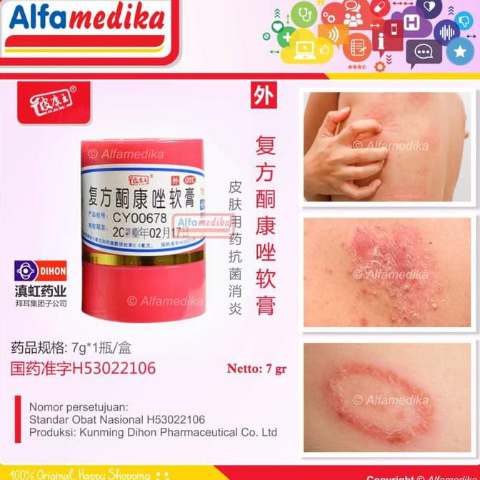 Krim Obat Gatal Kulit Infeksi Jamur Kelamin Selangkangan
