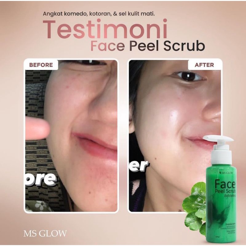 Face Peel Scrub Ms Glow