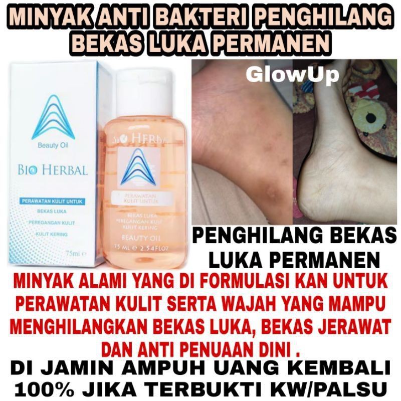 BIO OIL STRETCH MARK PENGHILANG BEKAS LUKA BIO HERBAL BEAUTY OIL 75ML