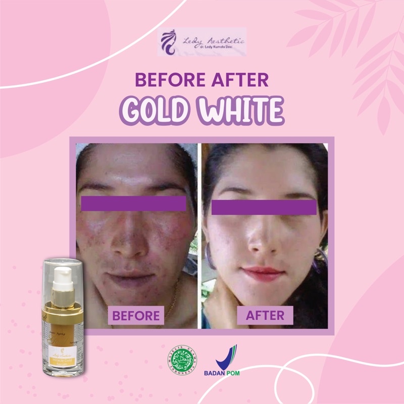 Jual LEDY SKINCARE MIRACLE GOLD SERUM by dr. Ledy Kumala Shopee Indonesia