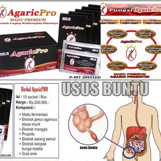 OBAT RADANG USUS BUNTU AMPUH MANJUR TANPA OPERASI Shopee OBAT RADANG USUS BUNTU AMPUH MANJUR TANPA OPERASI Shopee