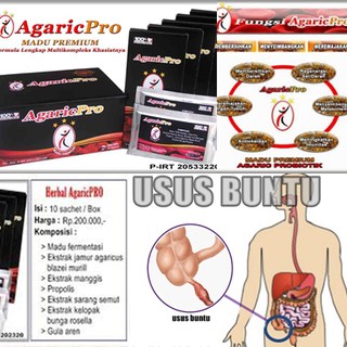  OBAT  RADANG USUS  BUNTU  AMPUH MANJUR TANPA  OPERASI  Shopee 