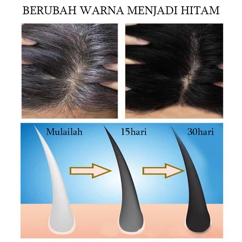 Serum Rambut Hitam Hitam spray 100ml Polygonum Multiflorum Rambut putih alami hingga rambut hitam 100% ekstrak tumbuhan asli Rambut putih tercepat di Indonesia menjadi rambut hitam Rambut hitam permanen Menutrisi Akar Rambut Rambut Putih-5