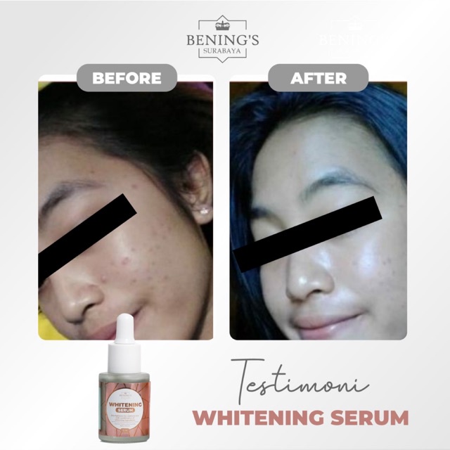 BENING'S SERUM WHITENING | MENCERAHKAN &amp; MENGGLOWINGKAN | BPOM &amp; HALAL