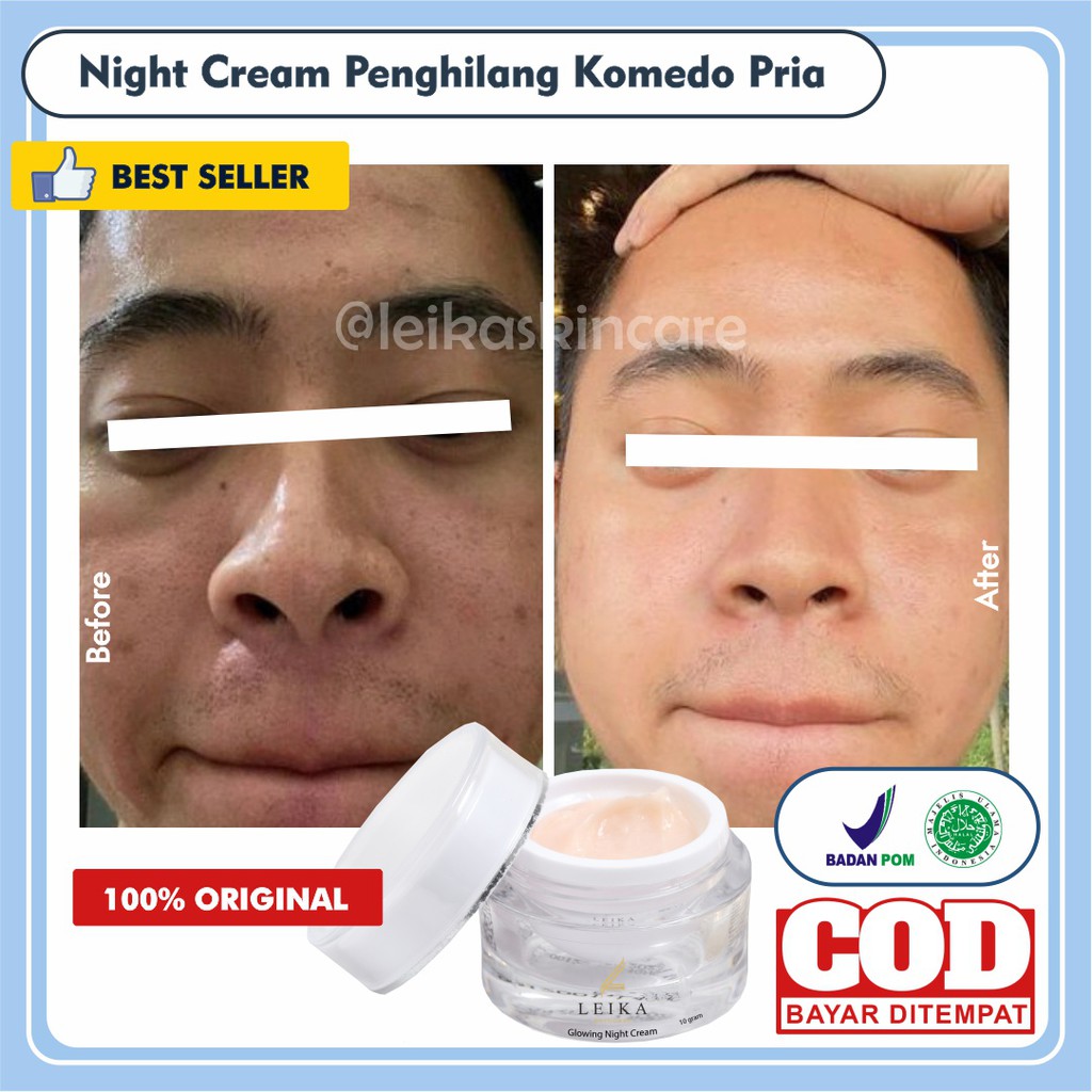 [KRIM MALAM PENGHILANG KOMEDO] Penghilang Komedo Hidung Penghilang Komedo Dan Pori Pori Penghilang K