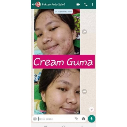 ❤️RC❤️Ghuma Skincare Jerawat