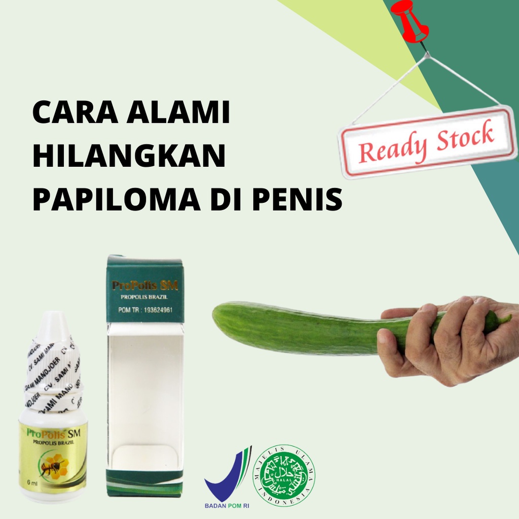 obat kutil kelamin, obat kutil, salep kutil, penghilang kutil, obat papiloma, obat kutil kelamin pri