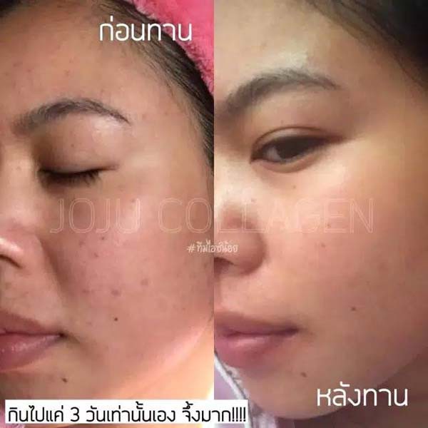 JOJU COLLAGEN update dari CL COLLAGEN  GLUTA PEMUTIH_Lynn Design