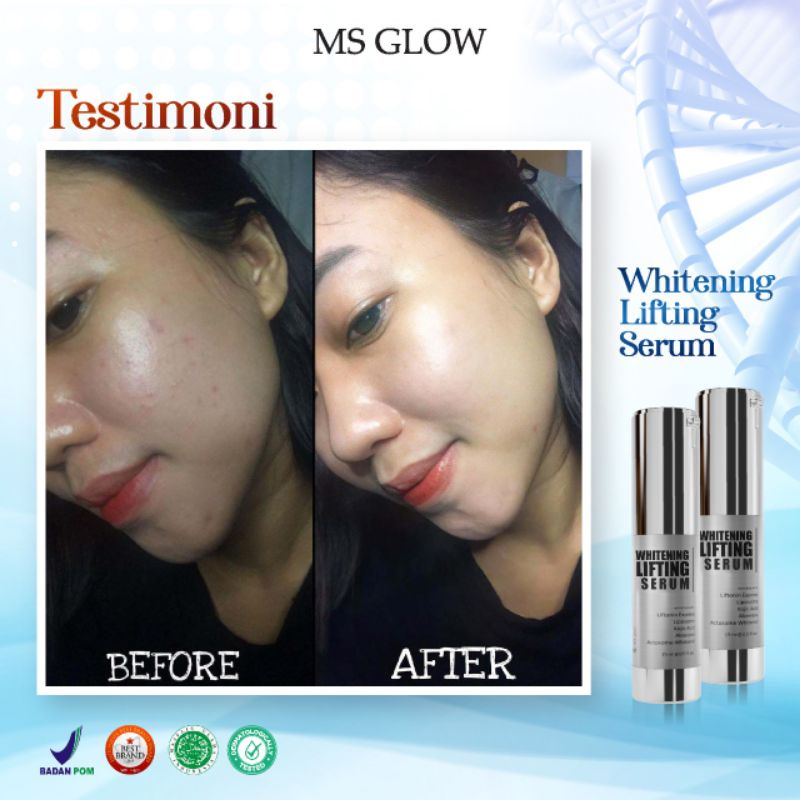 Lifting Whitening Serum 15 ml MS GLOW