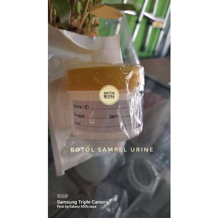 Jual Botol Sampel Urine Pot Urine Botol Urine Botol Pot Sampel Sample Container Steril