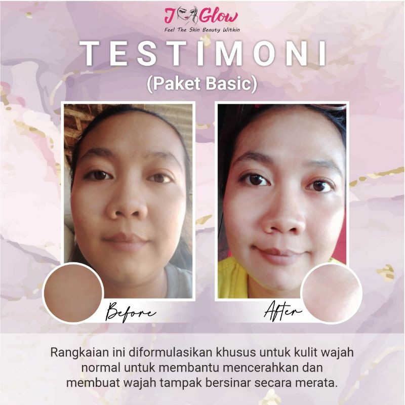 Jglow Skincare Paket Basic Whitening Skin Cream glowing