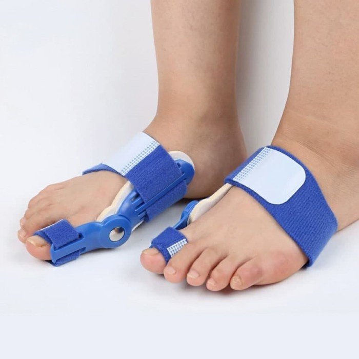 Buy 1 Get 1 Bunion Corrector Penyangga jempol kaki big toe protector